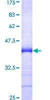 CD66a / CEACAM1 Protein - 12.5% SDS-PAGE Stained with Coomassie Blue.