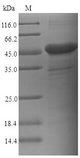 CD66c / CEACAM6 Protein - (Tris-Glycine gel) Discontinuous SDS-PAGE (reduced) with 5% enrichment gel and 15% separation gel.