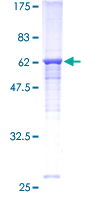 CD66c / CEACAM6 Protein - 12.5% SDS-PAGE of human CEACAM6 stained with Coomassie Blue