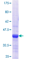 CD66c / CEACAM6 Protein - 12.5% SDS-PAGE Stained with Coomassie Blue.