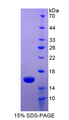 CD66c / CEACAM6 Protein - Recombinant  Carcinoembryonic Antigen Related Cell Adhesion Molecule 6 By SDS-PAGE