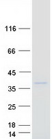 CD66d / CEACAM3 Protein - Purified recombinant protein CEACAM3 was analyzed by SDS-PAGE gel and Coomassie Blue Staining