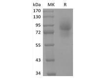 CD68 Protein - Recombinant Human CD68/SR-D1 (C-Fc)