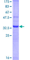 CD68 Protein - 12.5% SDS-PAGE Stained with Coomassie Blue.