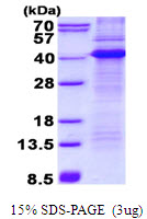 CD68 Protein