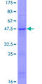 CD69 Protein - 12.5% SDS-PAGE of human CD69 stained with Coomassie Blue