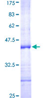 CD69 Protein - 12.5% SDS-PAGE Stained with Coomassie Blue.