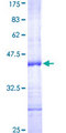 CD69 Protein - 12.5% SDS-PAGE Stained with Coomassie Blue.