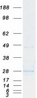 CD69 Protein - Purified recombinant protein CD69 was analyzed by SDS-PAGE gel and Coomassie Blue Staining