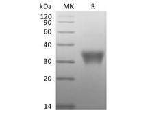 CD7 Protein - Recombinant Human CD7/Leu-9 (C-6His-Avi) Biotinylated