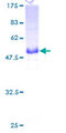 CD7 Protein - 12.5% SDS-PAGE of human CD7 stained with Coomassie Blue