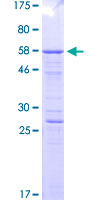 CD71 / Transferrin Receptor Protein - 12.5% SDS-PAGE Stained with Coomassie Blue.