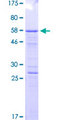 CD71 / Transferrin Receptor Protein - 12.5% SDS-PAGE Stained with Coomassie Blue.