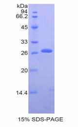 CD71 / Transferrin Receptor Protein - Recombinant Transferrin Receptor By SDS-PAGE