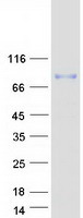 CD71 / Transferrin Receptor Protein - Purified recombinant protein TFRC was analyzed by SDS-PAGE gel and Coomassie Blue Staining