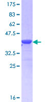 CD72 Protein - 12.5% SDS-PAGE Stained with Coomassie Blue.