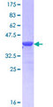 CD72 Protein - 12.5% SDS-PAGE Stained with Coomassie Blue.