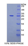 CD72 Protein - Recombinant Cluster Of Differentiation 72 By SDS-PAGE