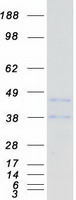 CD72 Protein - Purified recombinant protein CD72 was analyzed by SDS-PAGE gel and Coomassie Blue Staining