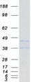 CD72 Protein - Purified recombinant protein CD72 was analyzed by SDS-PAGE gel and Coomassie Blue Staining