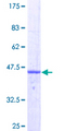 CD74 / CLIP Protein - 12.5% SDS-PAGE of human CD74 stained with Coomassie Blue
