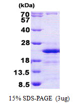 CD74 / CLIP Protein