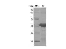 CD74 / CLIP Protein - Recombinant Human CD74 protein (His Tag)