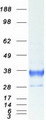 CD74 / CLIP Protein - Purified recombinant protein CD74 was analyzed by SDS-PAGE gel and Coomassie Blue Staining