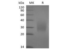 CD79A / CD79 Alpha Protein - Recombinant Human CD79A(C-6His)