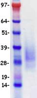 CD79A / CD79 Alpha Protein