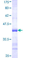 CD79A / CD79 Alpha Protein - 12.5% SDS-PAGE Stained with Coomassie Blue.