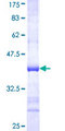 CD79A / CD79 Alpha Protein - 12.5% SDS-PAGE Stained with Coomassie Blue.