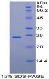 CD79A / CD79 Alpha Protein - Recombinant Immunoglobulin Associated Alpha By SDS-PAGE