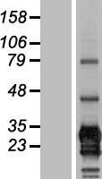 CD79B / CD79 Beta Protein - Western validation with an anti-DDK antibody * L: Control HEK293 lysate R: Over-expression lysate