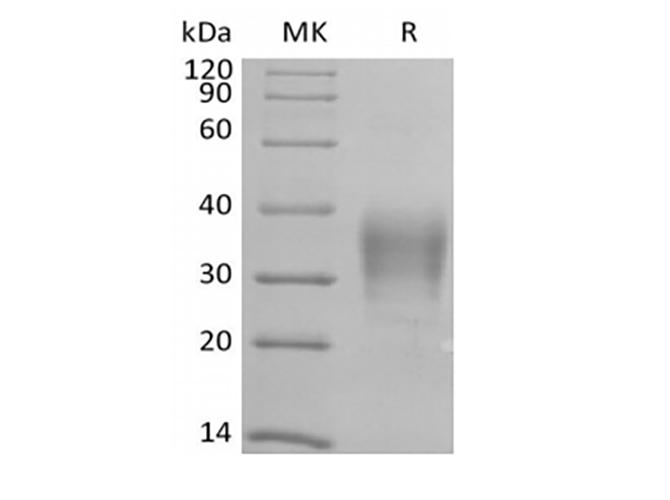 CD79B / CD79 Beta Protein - Recombinant Human CD79B/B29 (C-6His-Avi) Biotinylated