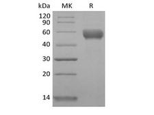 CD79B / CD79 Beta Protein - Recombinant Human CD79B/B29 (C-Fc)