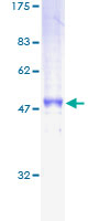 CD79B / CD79 Beta Protein - 12.5% SDS-PAGE of human CD79B stained with Coomassie Blue
