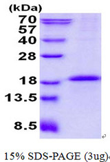 CD79B / CD79 Beta Protein
