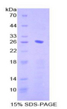 CD79B / CD79 Beta Protein - Recombinant Immunoglobulin Associated Beta By SDS-PAGE