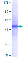 CD80 Protein - 12.5% SDS-PAGE of human CD80 stained with Coomassie Blue