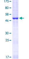 CD80 Protein - 12.5% SDS-PAGE of human CD80 stained with Coomassie Blue