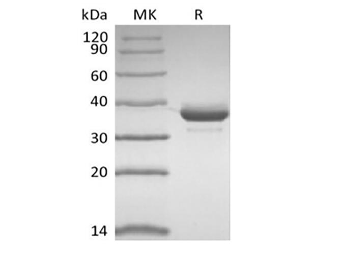 CD81 Protein - Recombinant Human CD81 (N-FC)