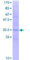 CD81 Protein - 12.5% SDS-PAGE Stained with Coomassie Blue.