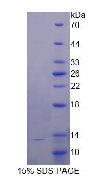 CD81 Protein - Recombinant Target Of The Antiproliferative Antibody 1 By SDS-PAGE