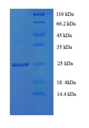 CD81 Protein