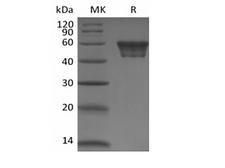CD82 Protein - Recombinant Human CD82 (N-Fc)