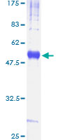 CD82 Protein - 12.5% SDS-PAGE of human CD82 stained with Coomassie Blue