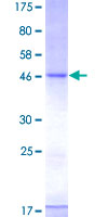 CD83 Protein - 12.5% SDS-PAGE of human CD83 stained with Coomassie Blue