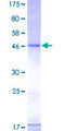 CD83 Protein - 12.5% SDS-PAGE of human CD83 stained with Coomassie Blue