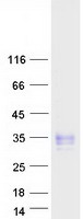 CD83 Protein - Purified recombinant protein CD83 was analyzed by SDS-PAGE gel and Coomassie Blue Staining